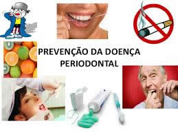O que são doenças Periodontais